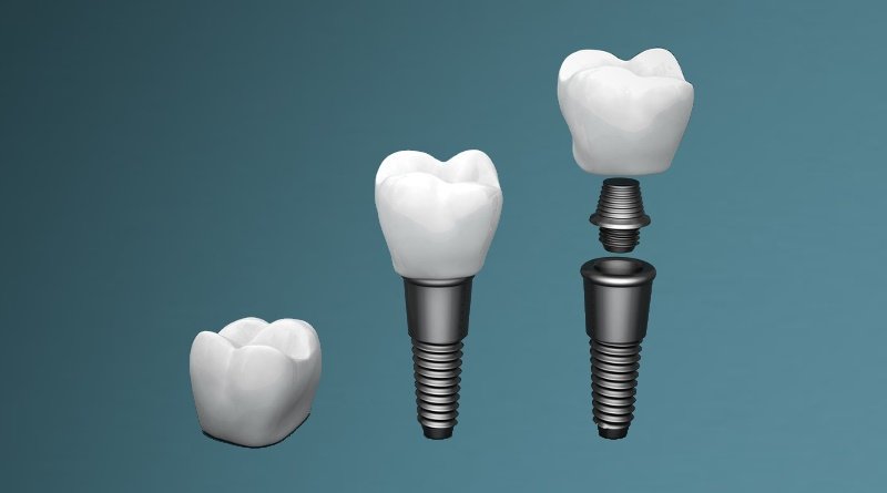 Dentomatic Med - clinica stomatologica